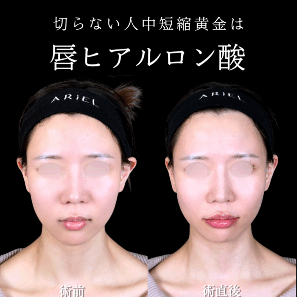 No.16815の症例写真