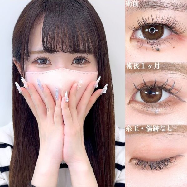No.16790の症例写真