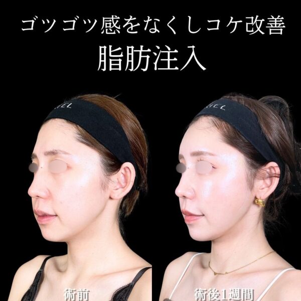 No.16806の症例写真