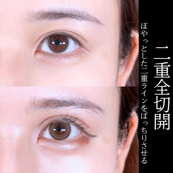No.16828の症例写真