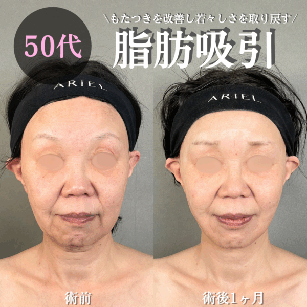 No.16842の症例写真