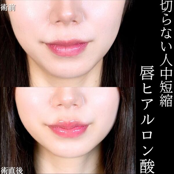 No.16680の症例写真