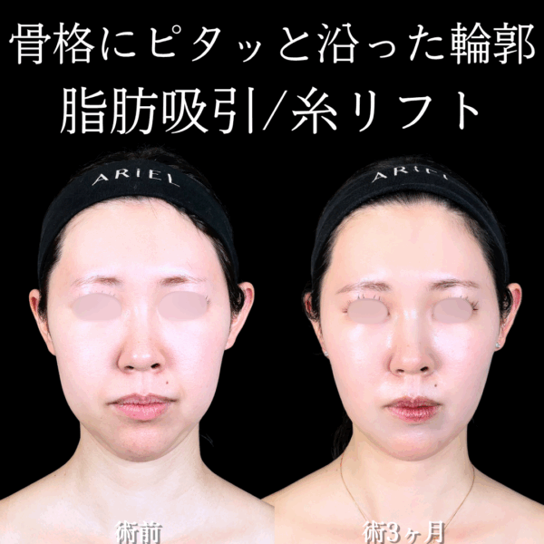No.16853の症例写真