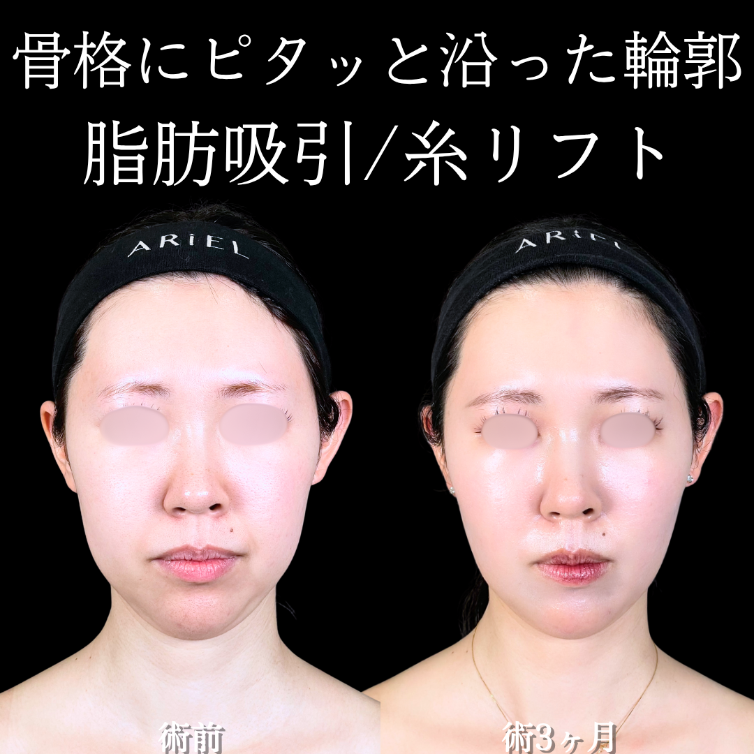 No.16853の症例写真