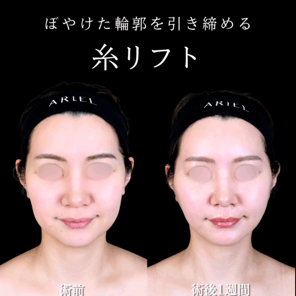 No.16895の症例写真