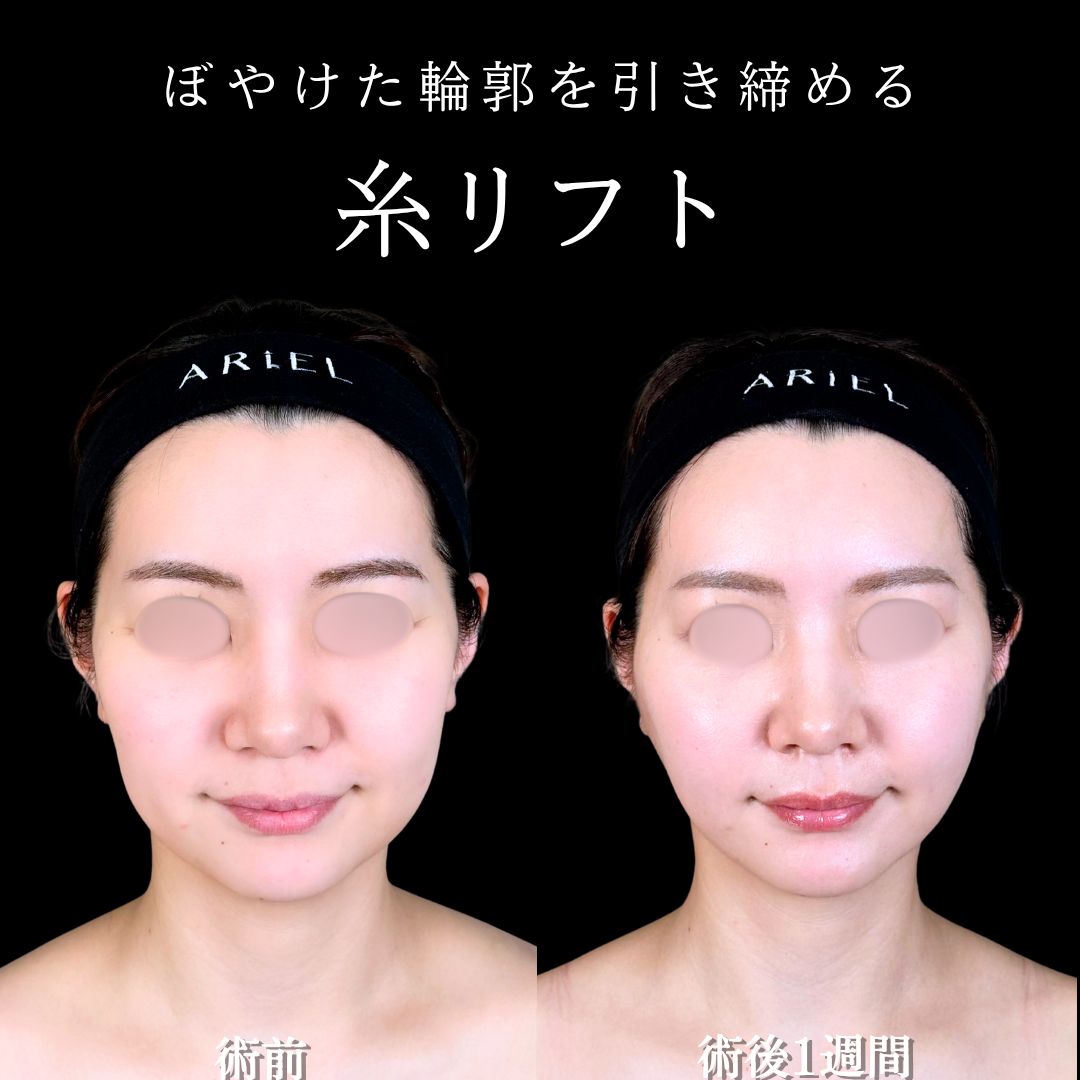 No.16895の症例写真