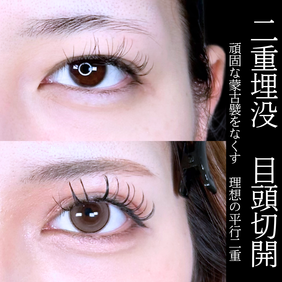 No.16574の症例写真1