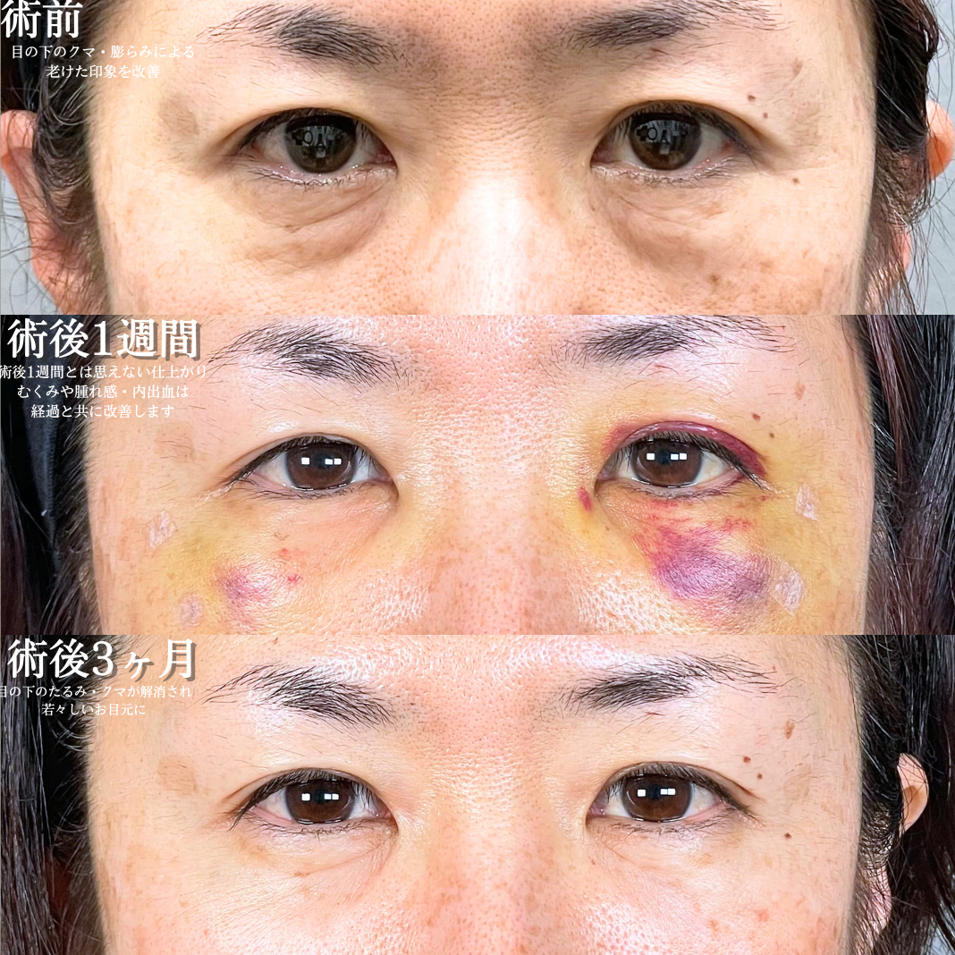 No.16754の症例写真1