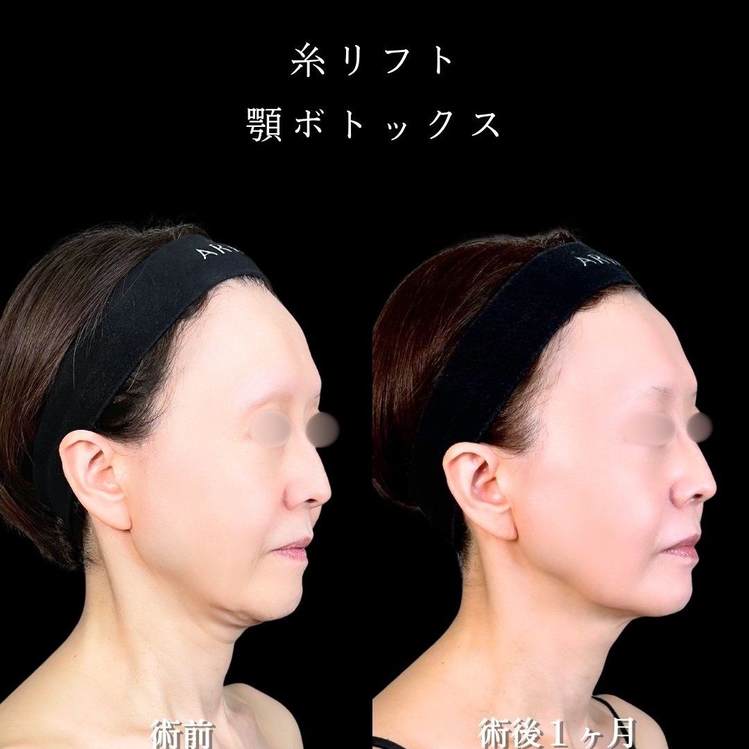No.16698の症例写真2