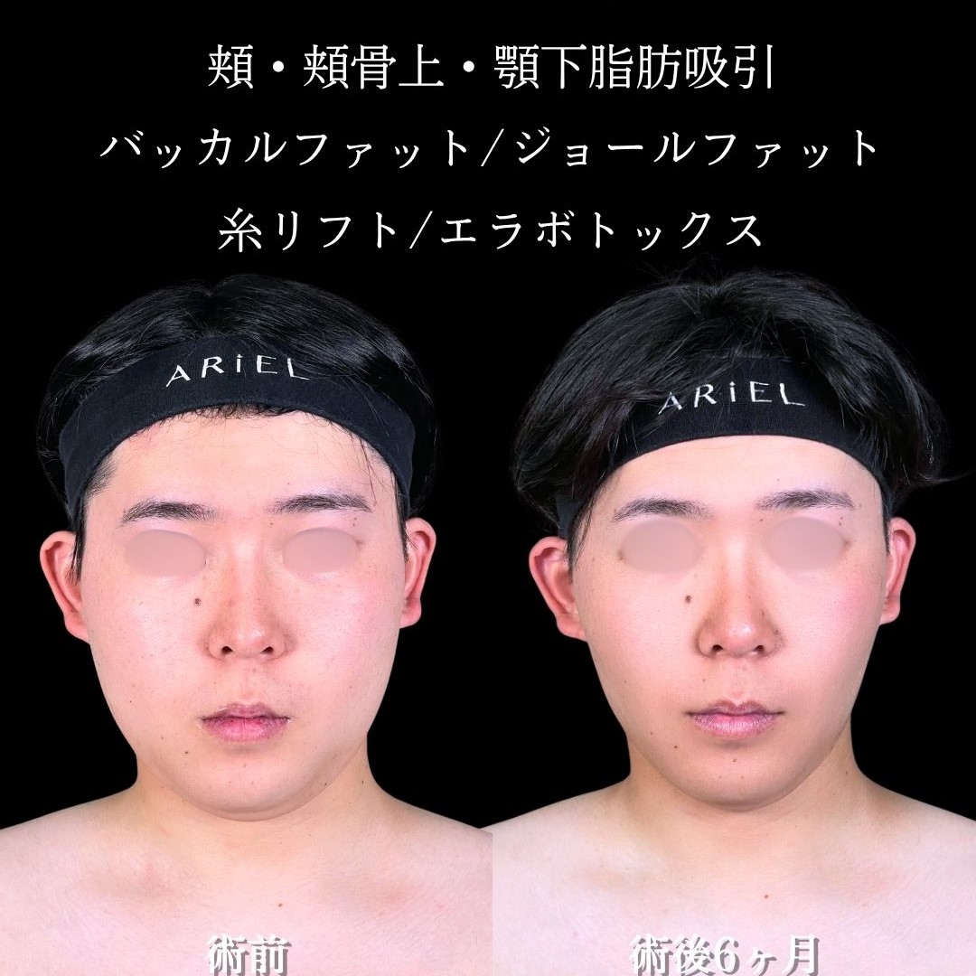 No.16705の症例写真2