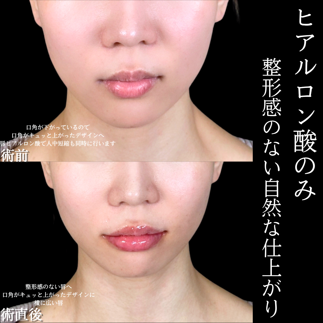No.16815の症例写真1
