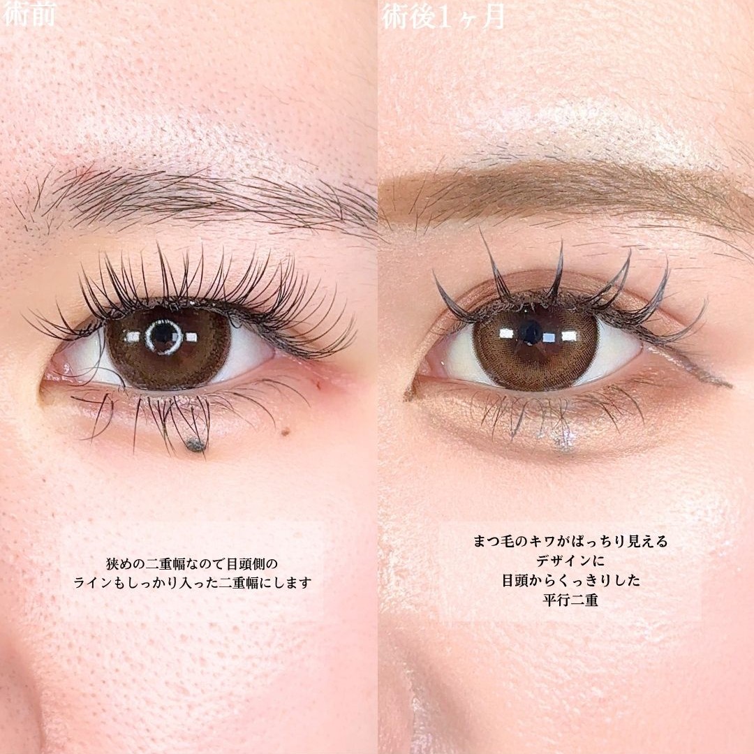 No.16790の症例写真1