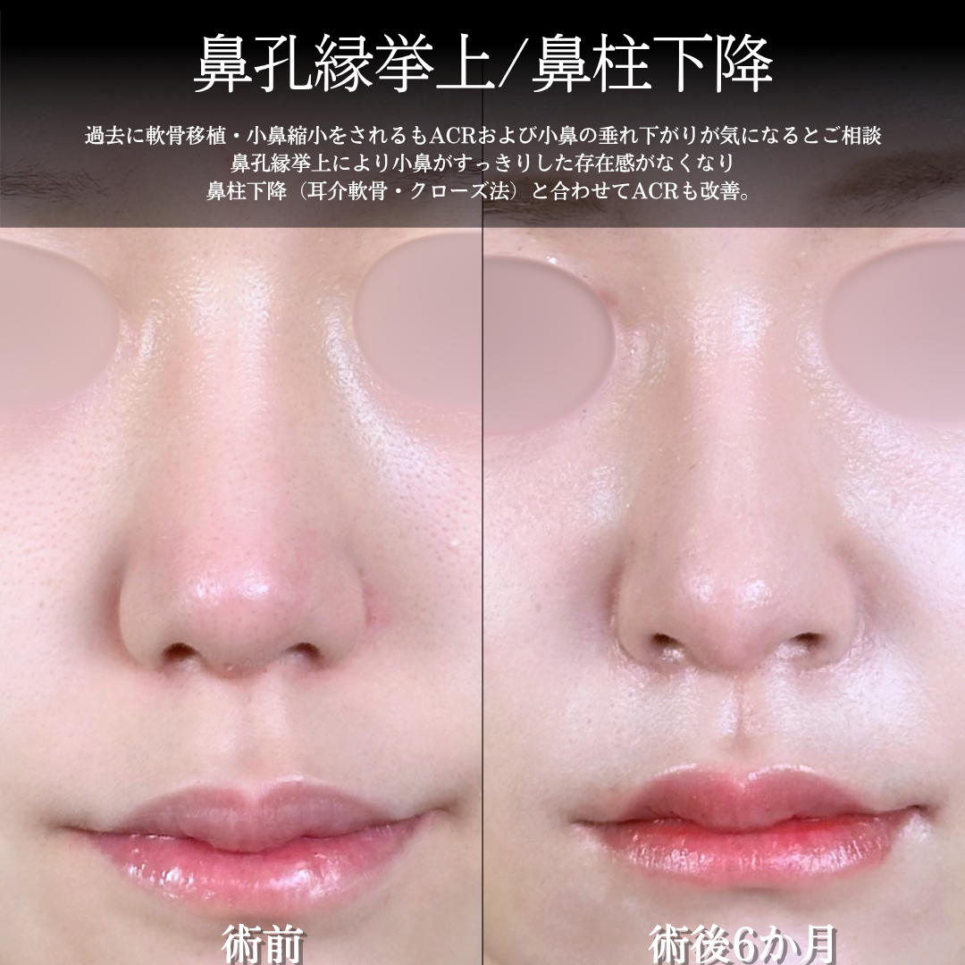 No.16821の症例写真1