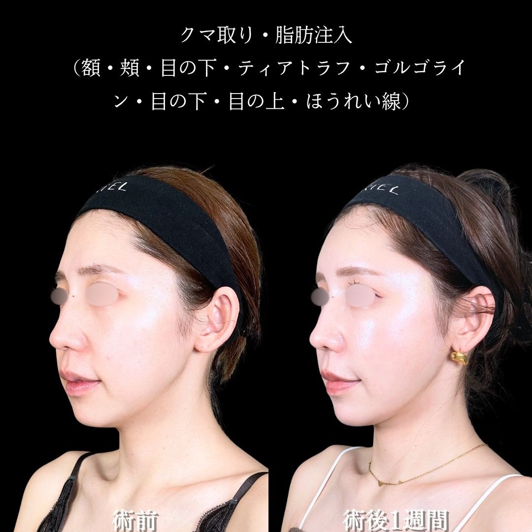 No.16806の症例写真1