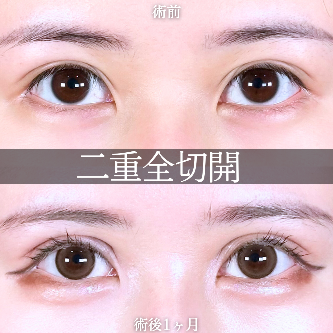 No.16828の症例写真1
