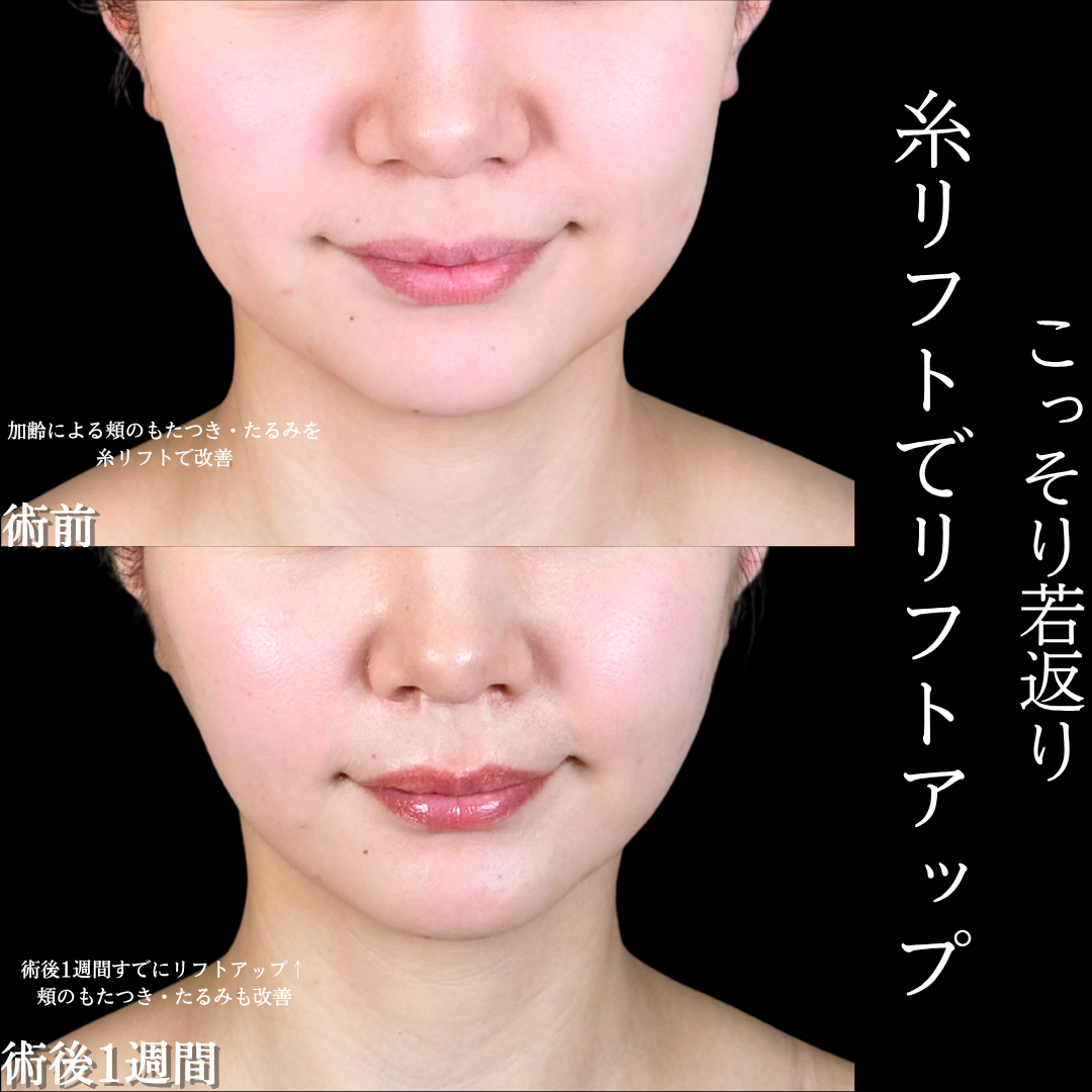 No.16895の症例写真1