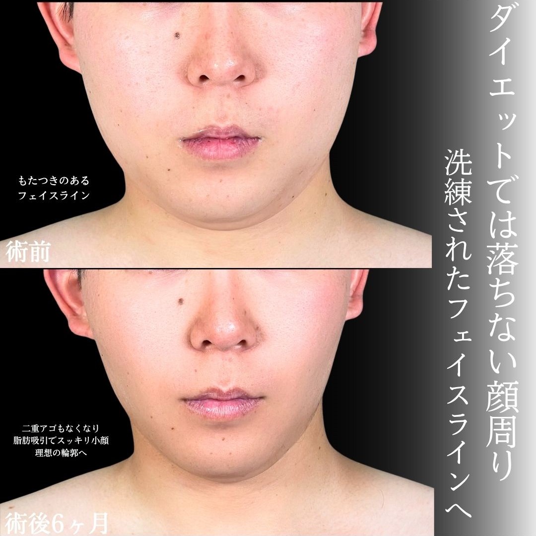 No.16705の症例写真1