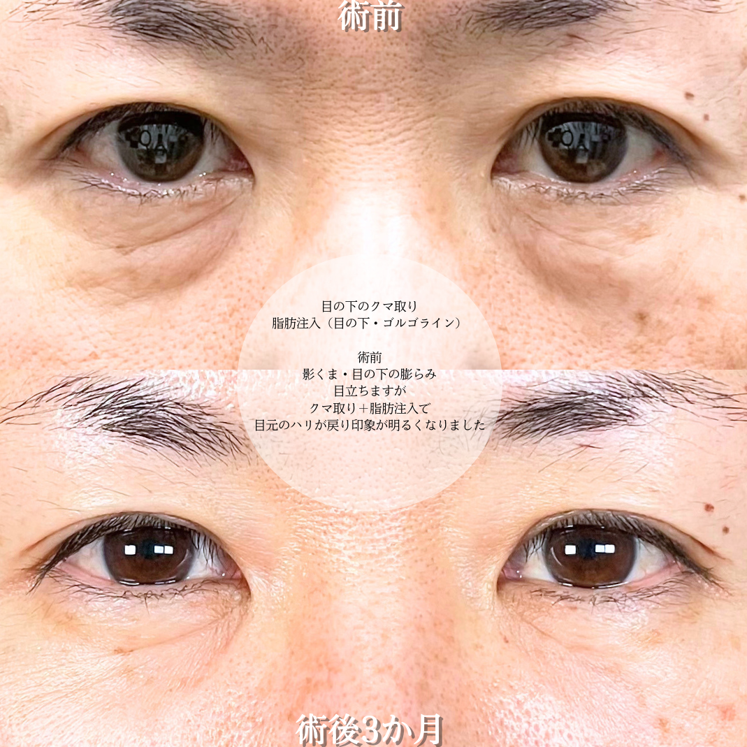 No.16754の症例写真2