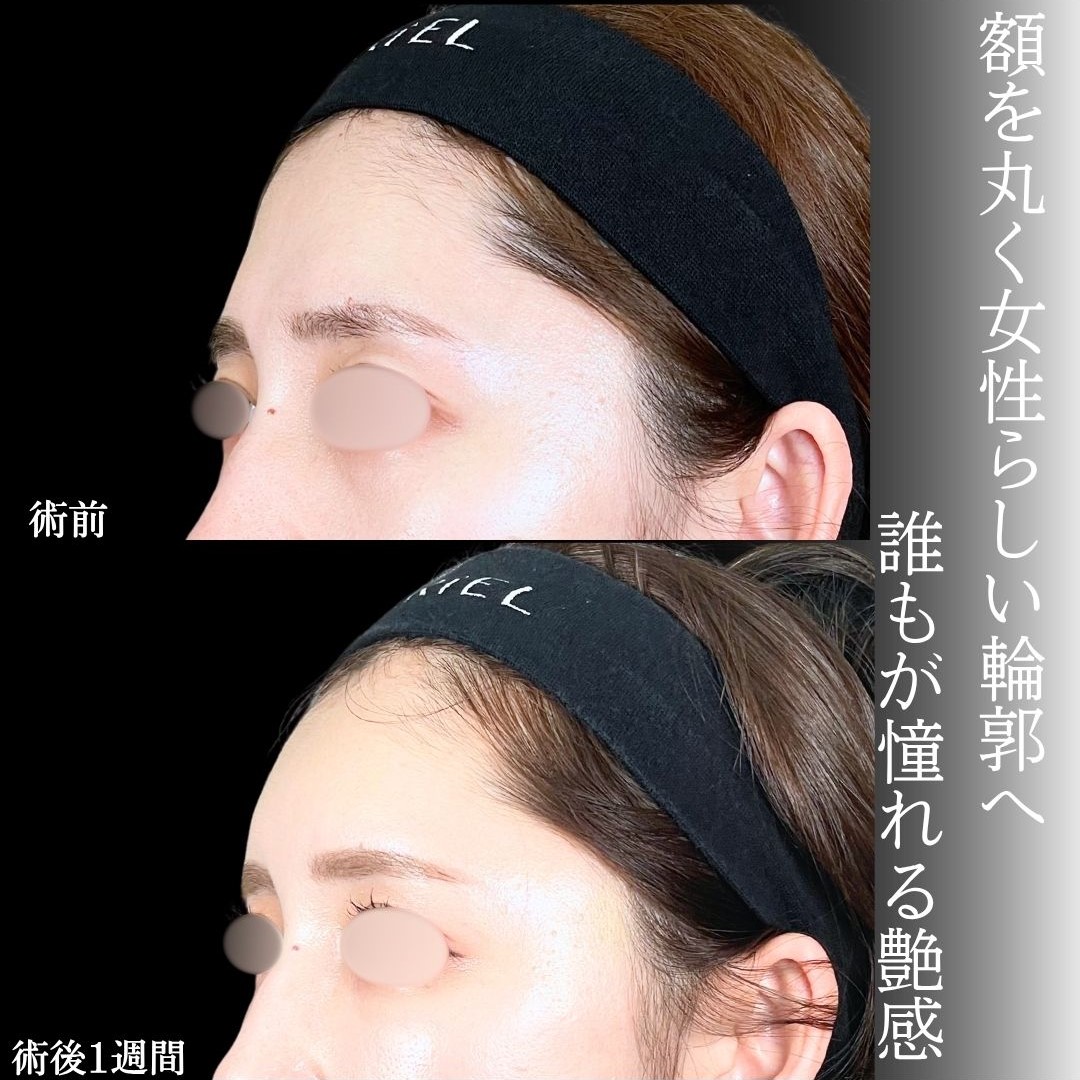 No.16806の症例写真2