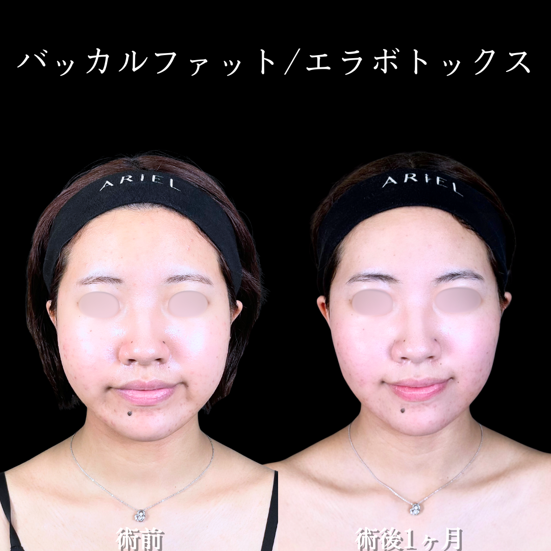 No.16763の症例写真2