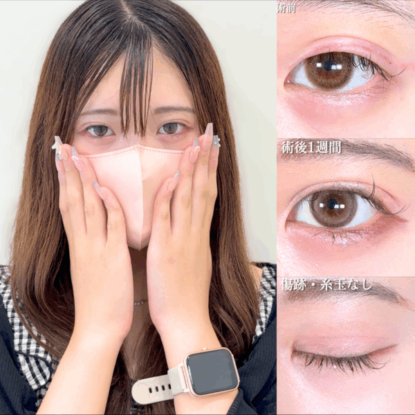 No.16835の症例写真