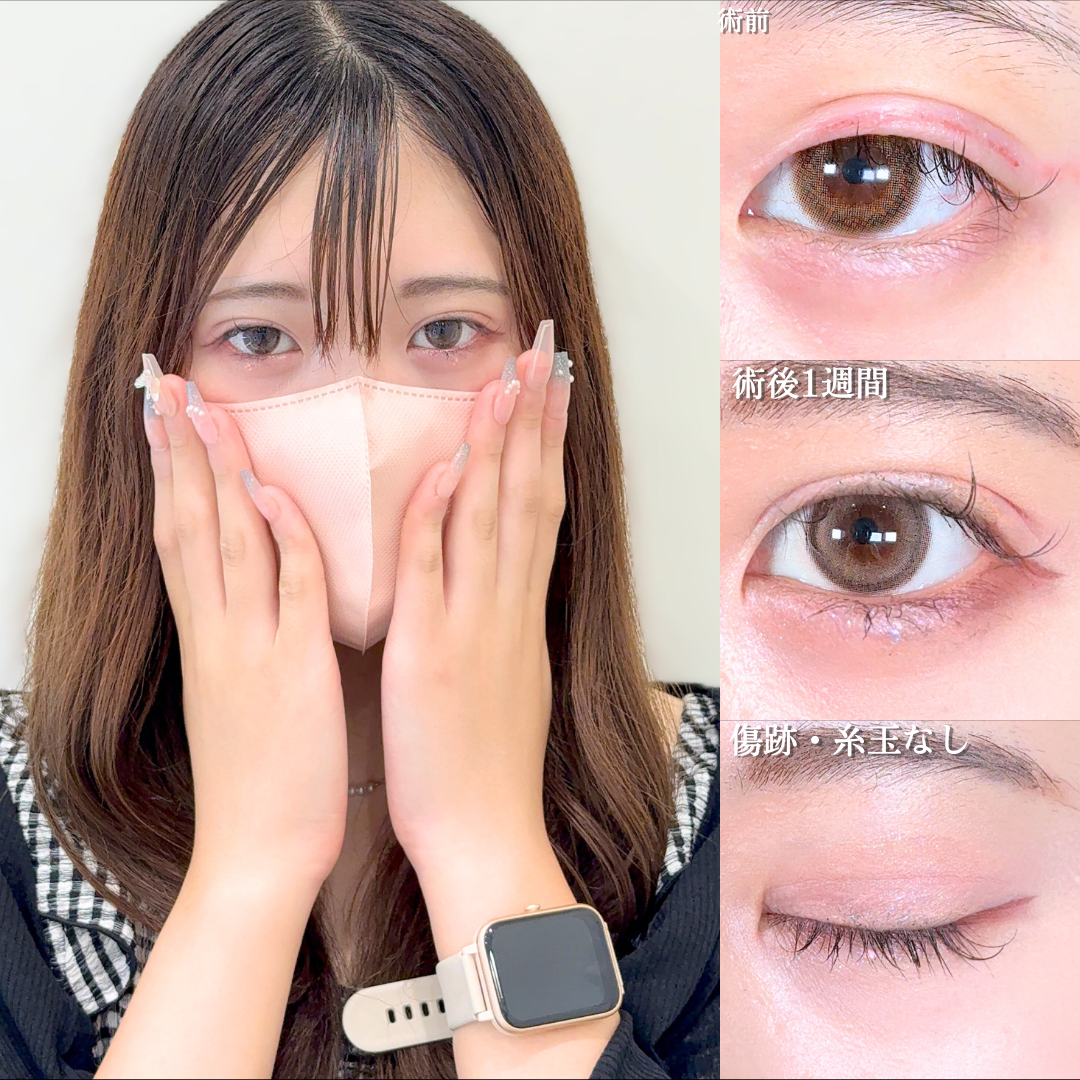 No.16835の症例写真