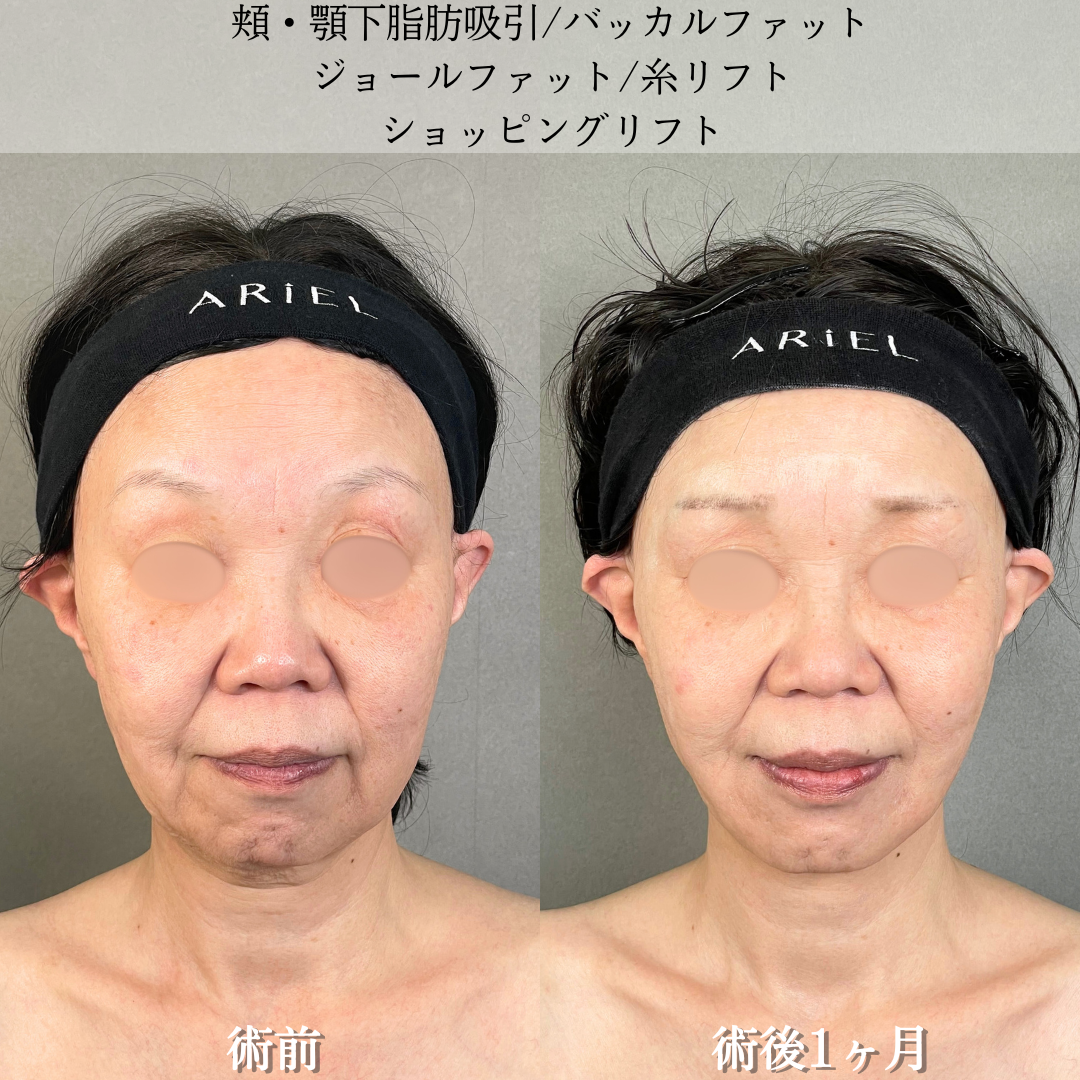 No.16842の症例写真2