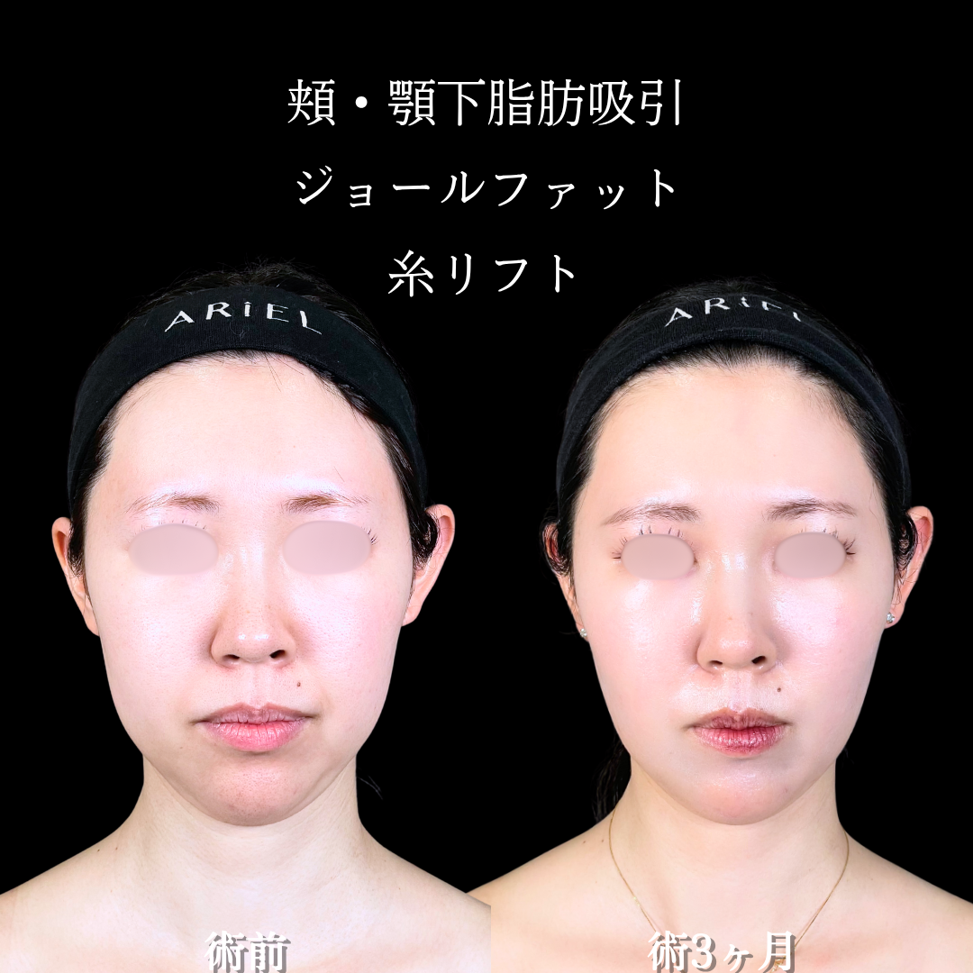 No.16853の症例写真1