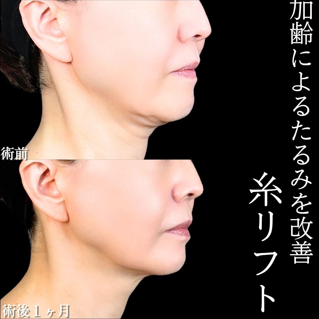 No.16698の症例写真1