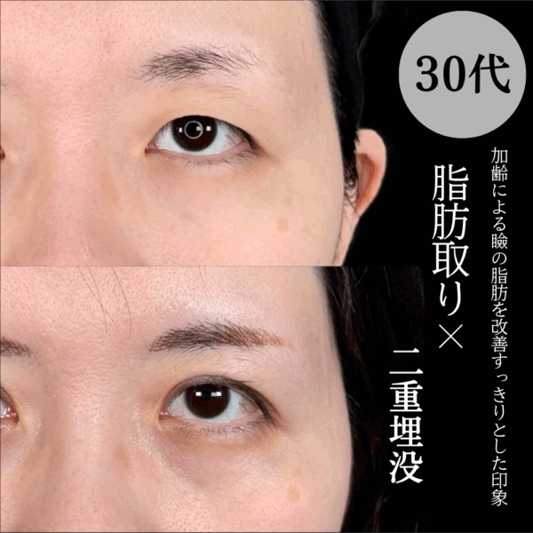 No.16870の症例写真