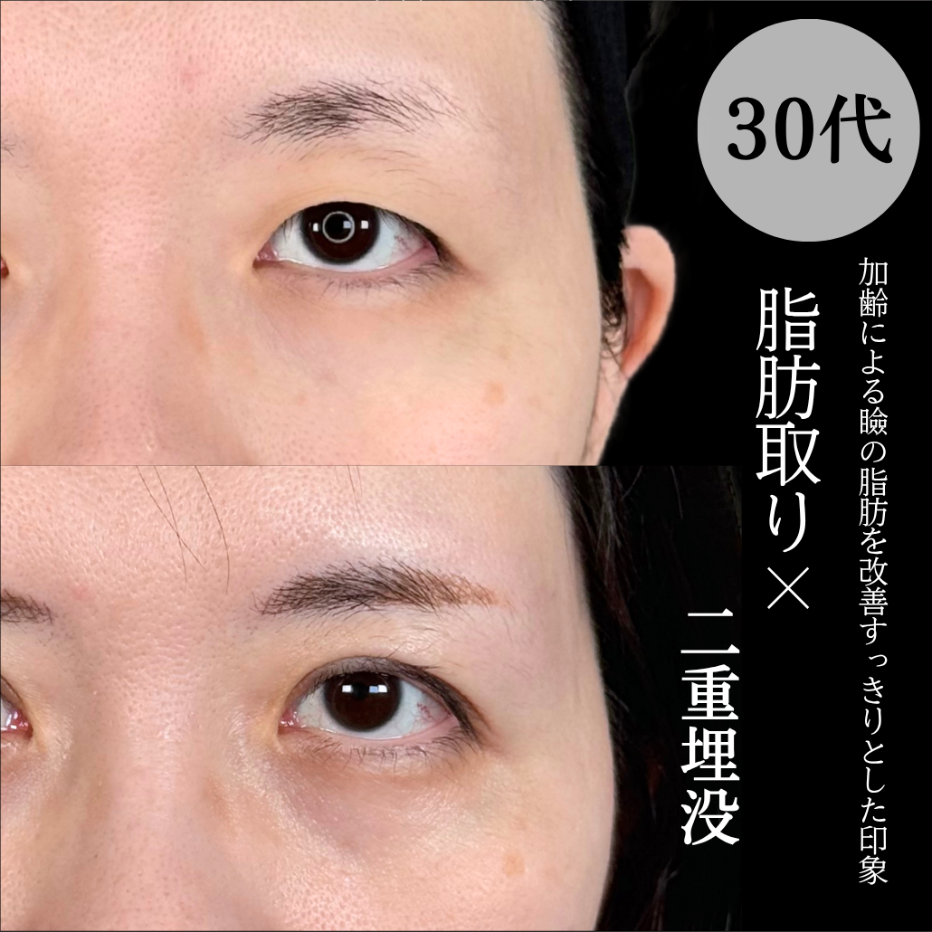 No.16870の症例写真