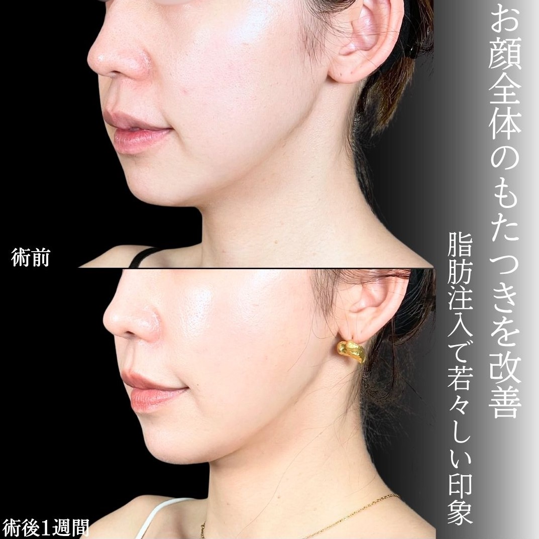 No.16806の症例写真3