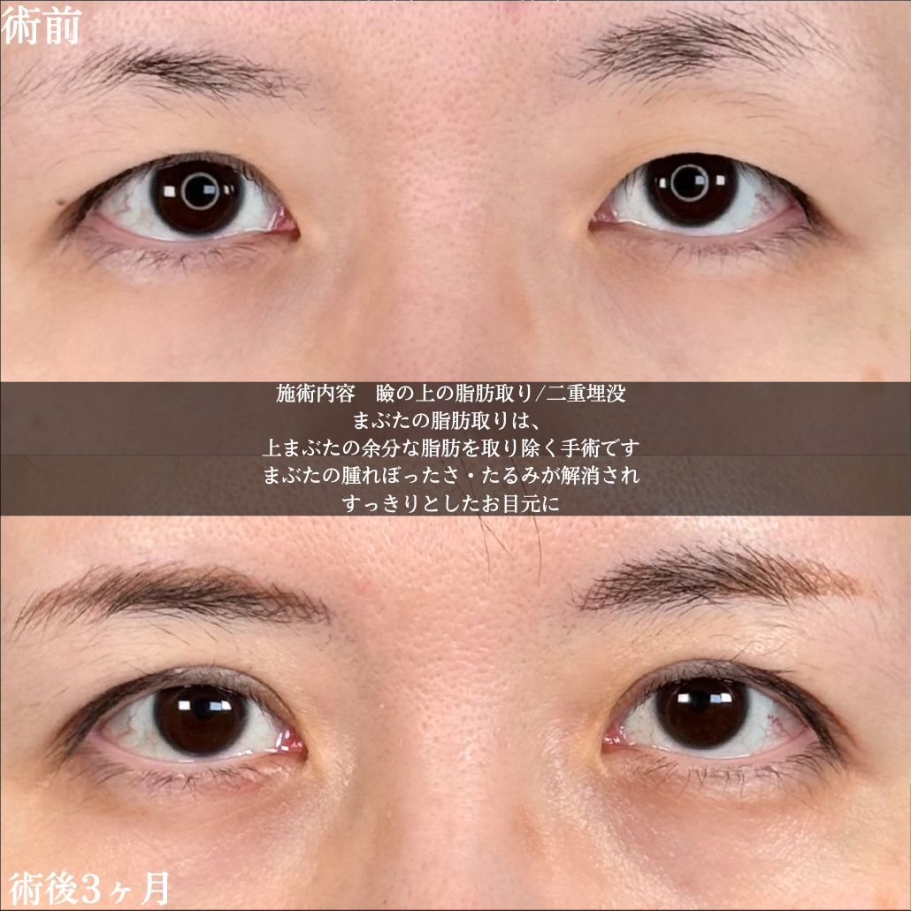 No.16870の症例写真1