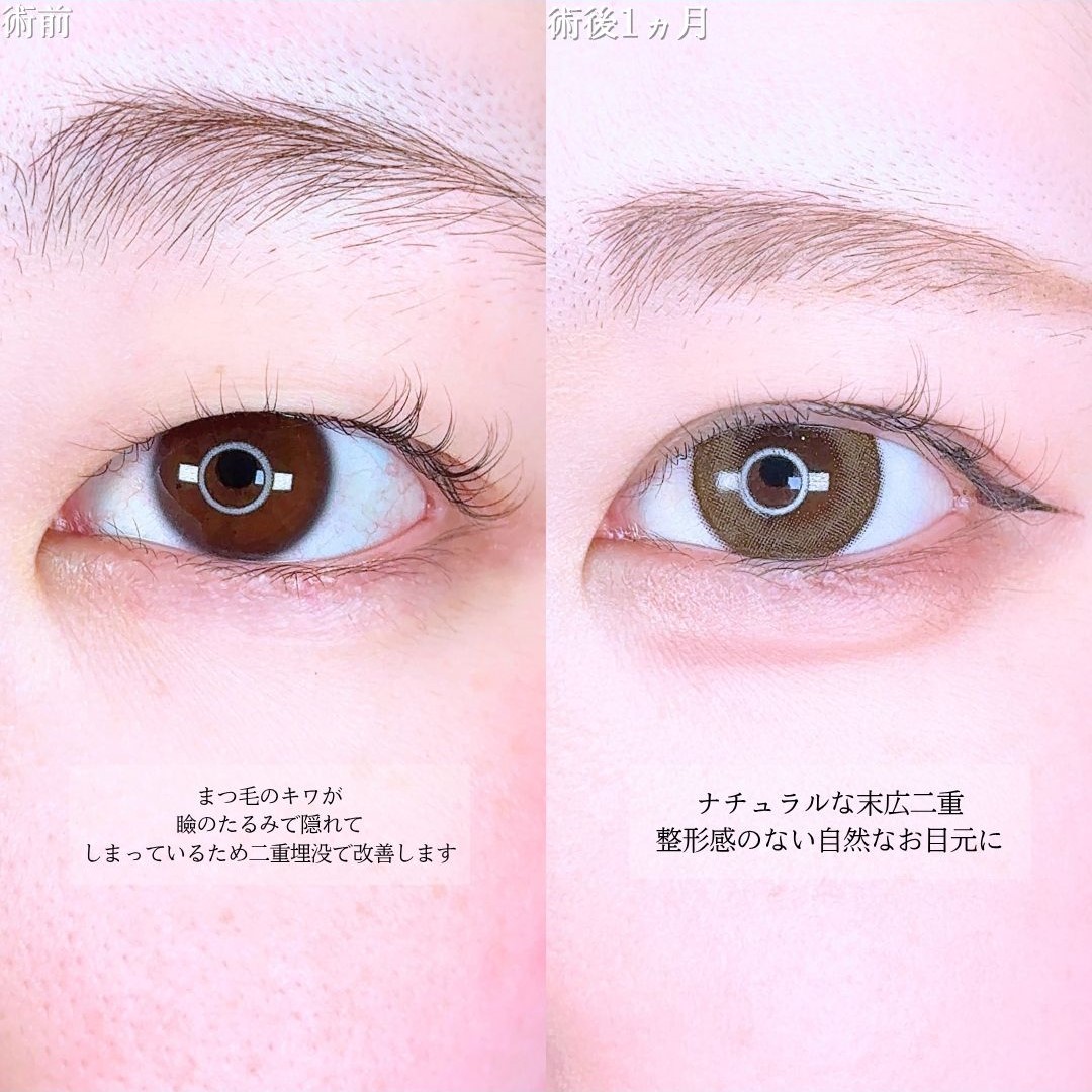 No.16783の症例写真1