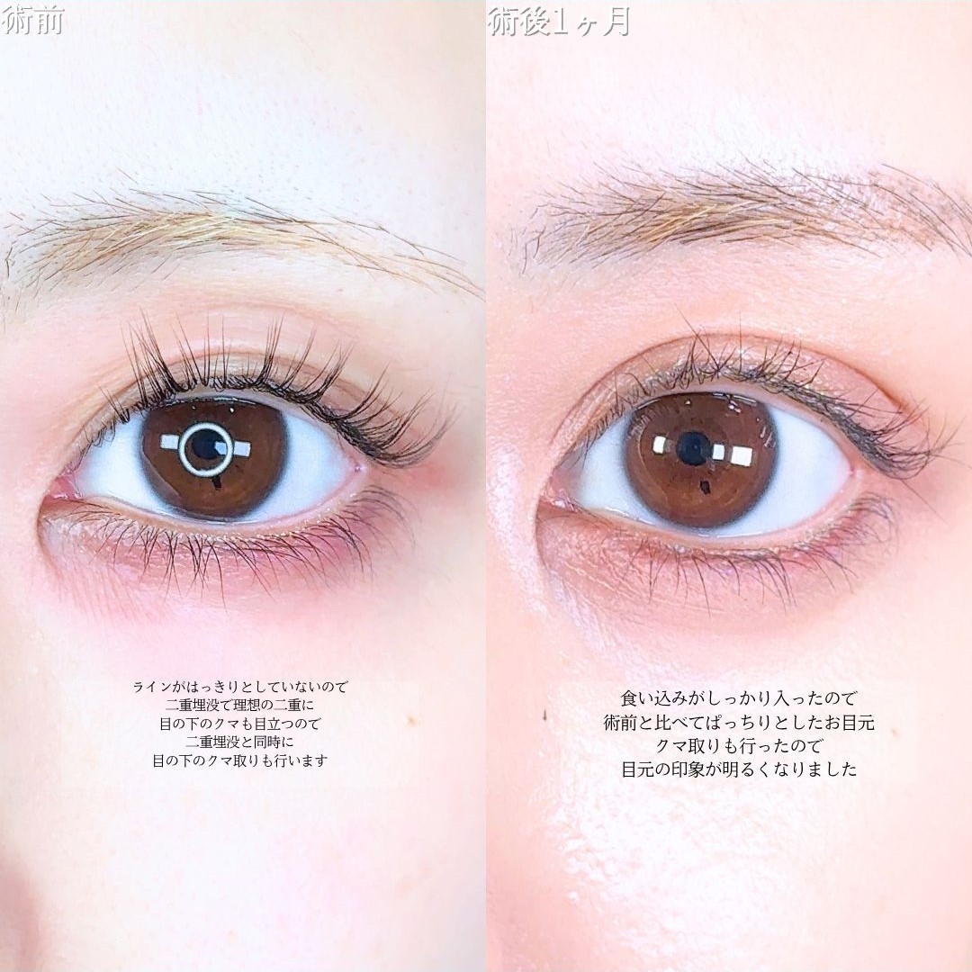 No.16883の症例写真1