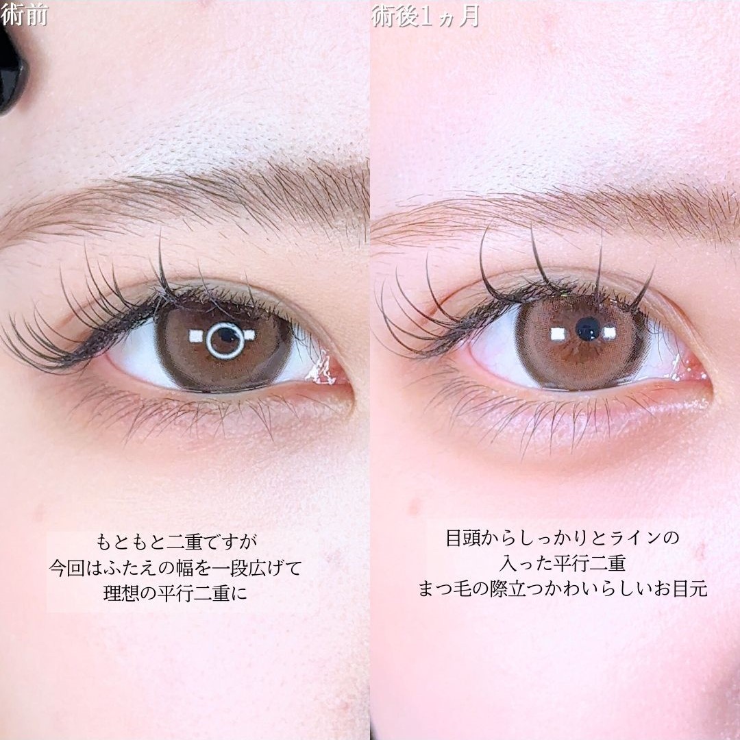 No.16749の症例写真1