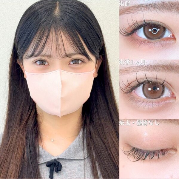 No.16749の症例写真