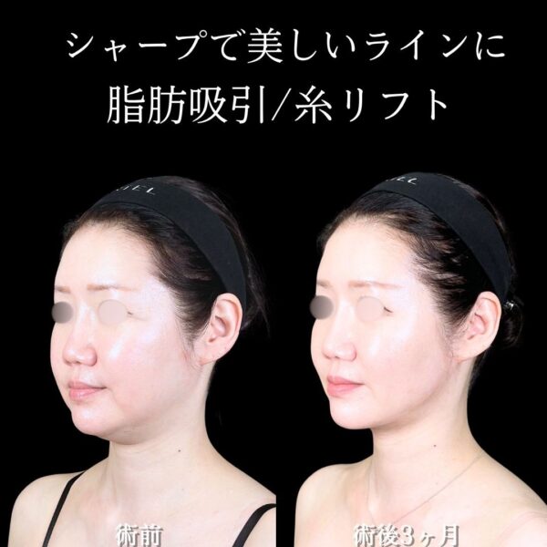 No.17108の症例写真