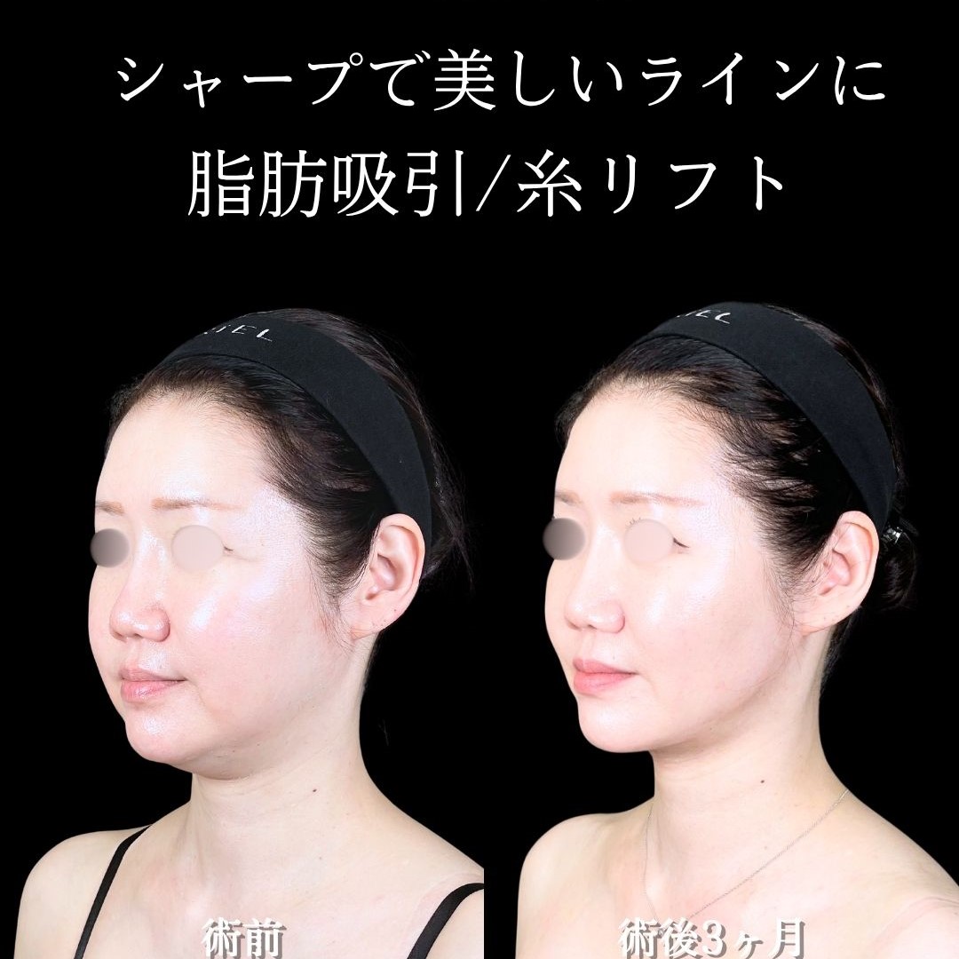 No.17108の症例写真 No.17108の症例写真