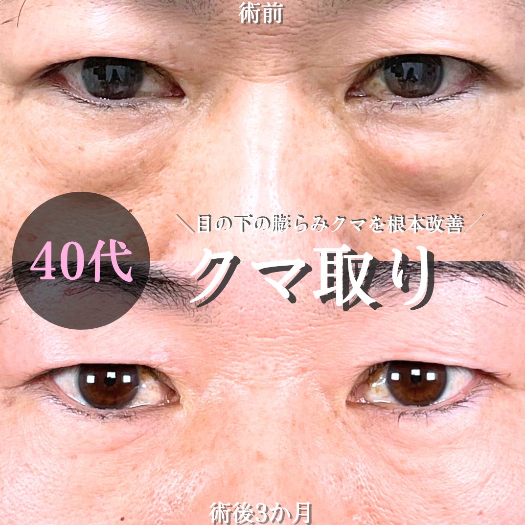 No.17071の症例写真