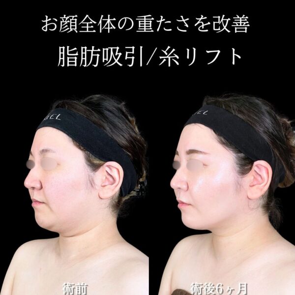 No.17301の症例写真