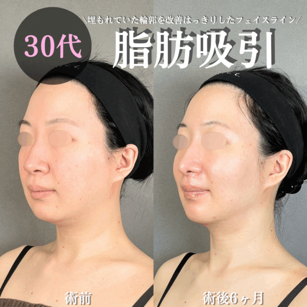 No.17554の症例写真
