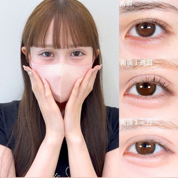 No.17101の症例写真