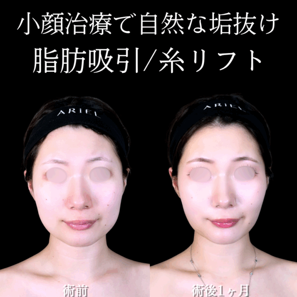 No.17047の症例写真