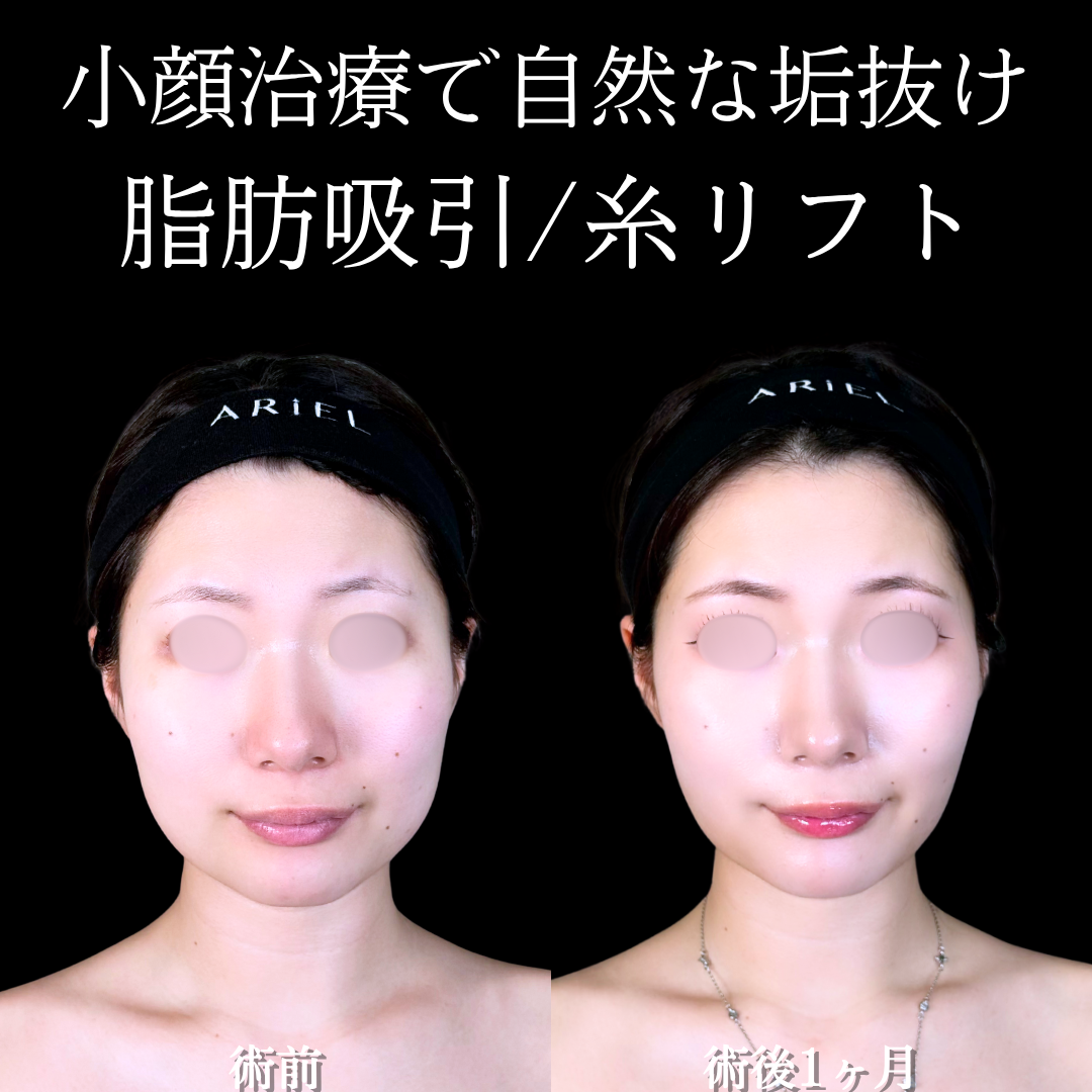 No.17047の症例写真 No.17047の症例写真