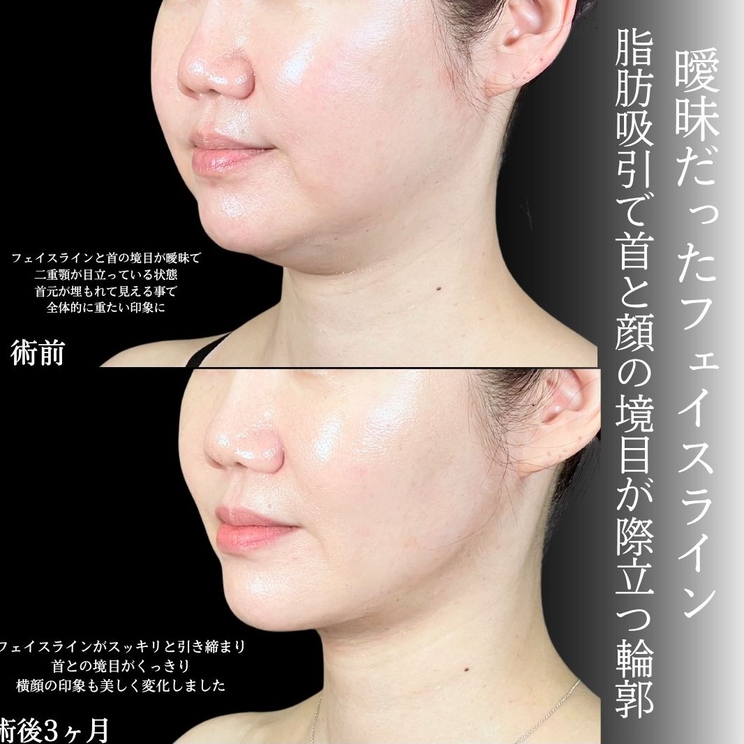 No.17108の症例写真1