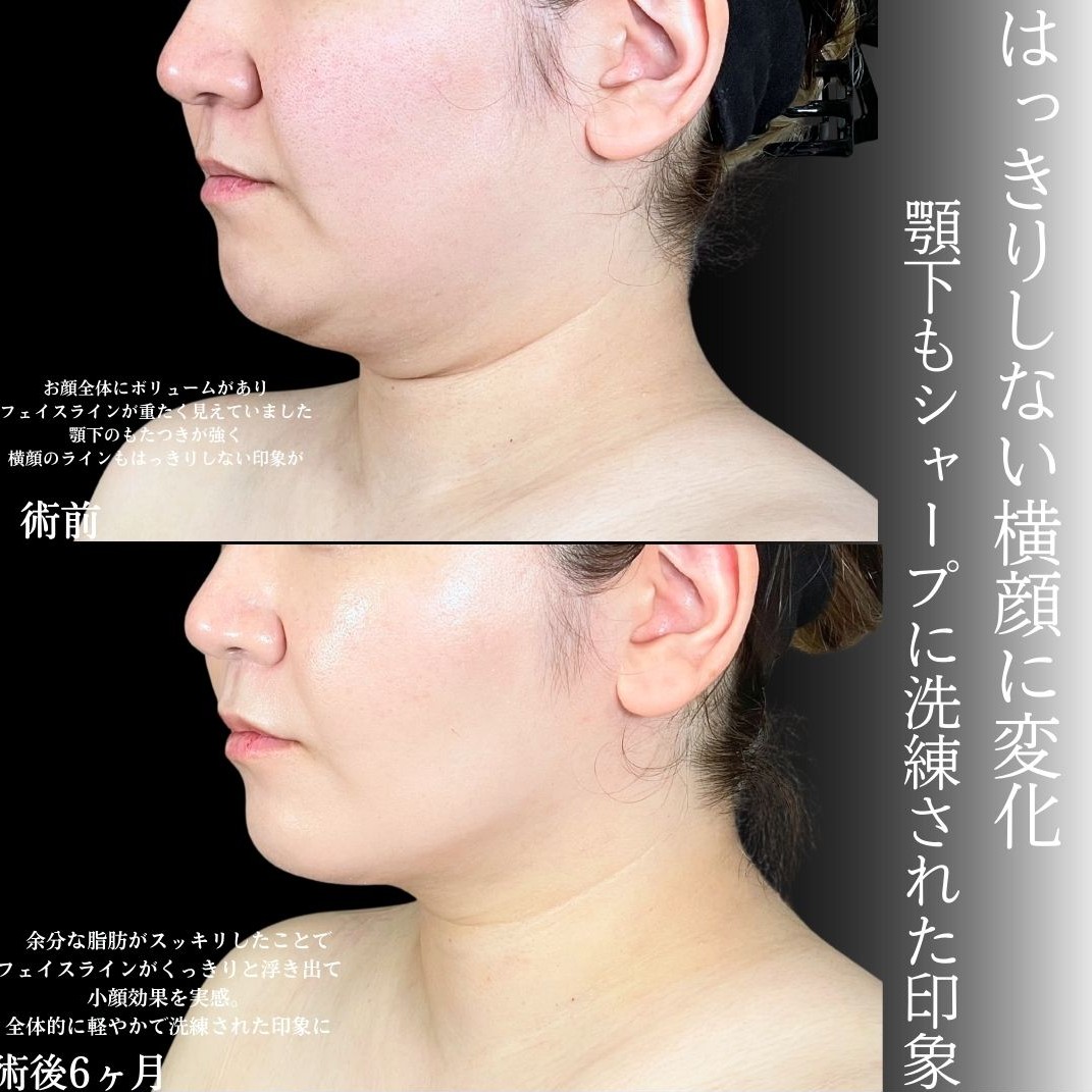 No.17301の症例写真2