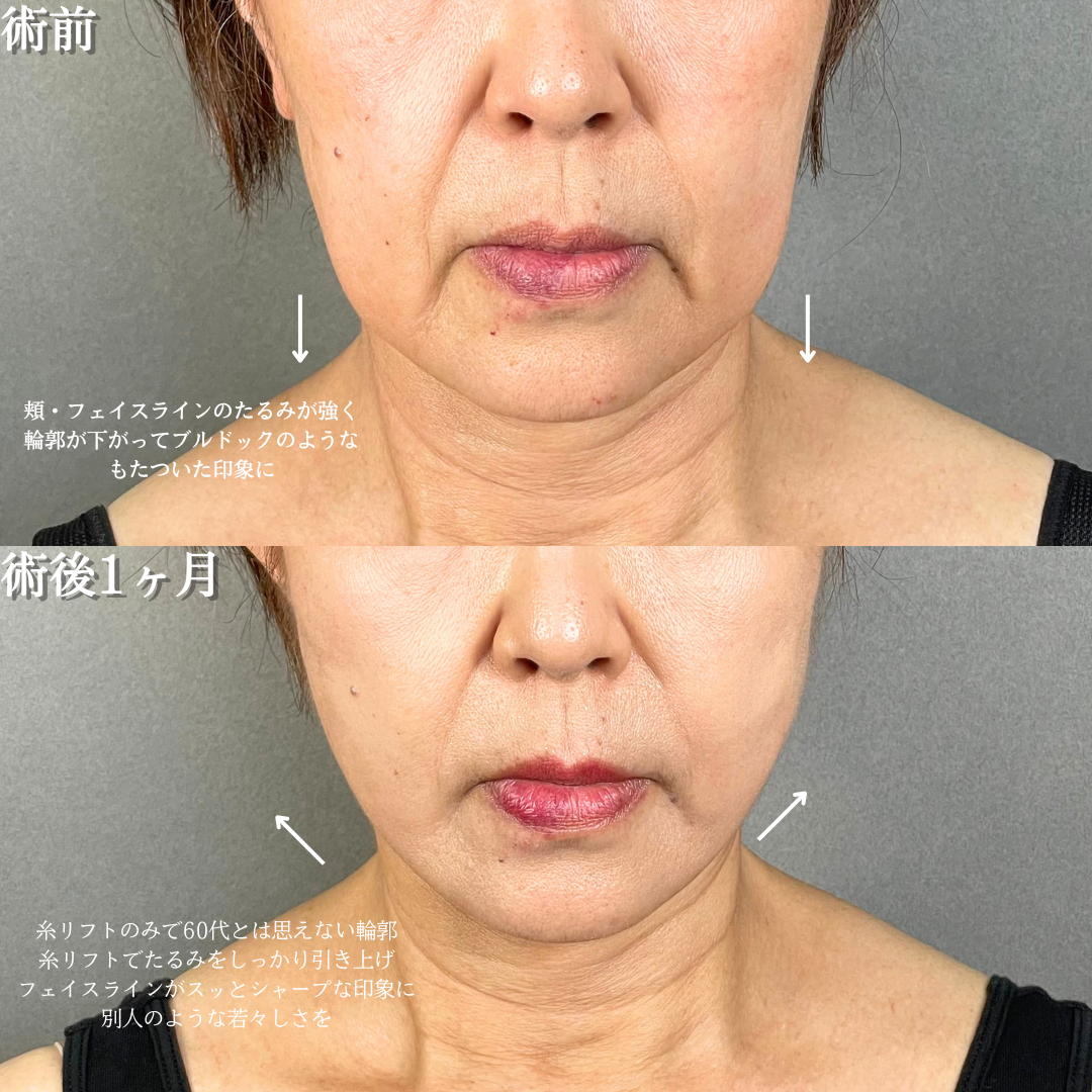 No.17211の症例写真1