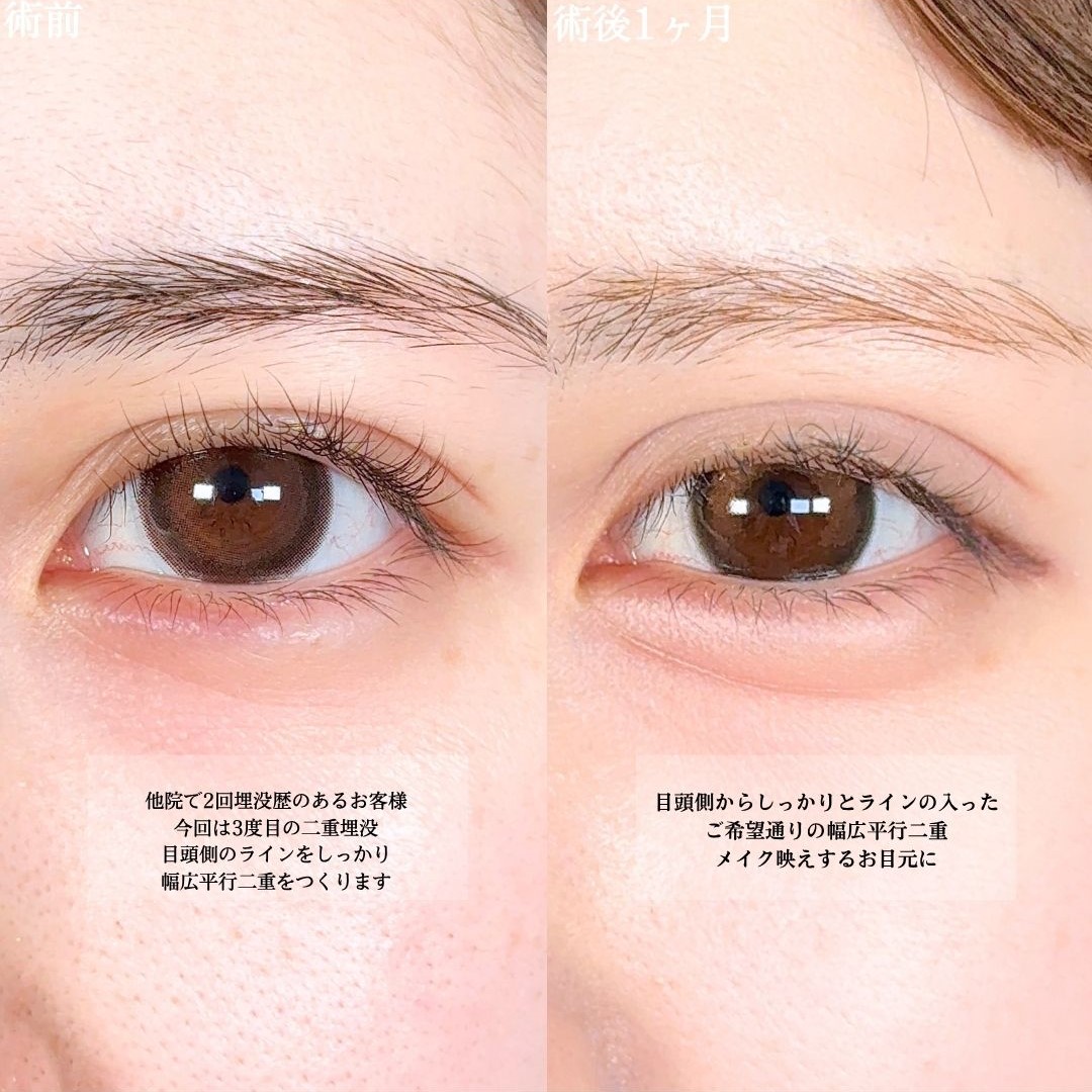 No.17101の症例写真1