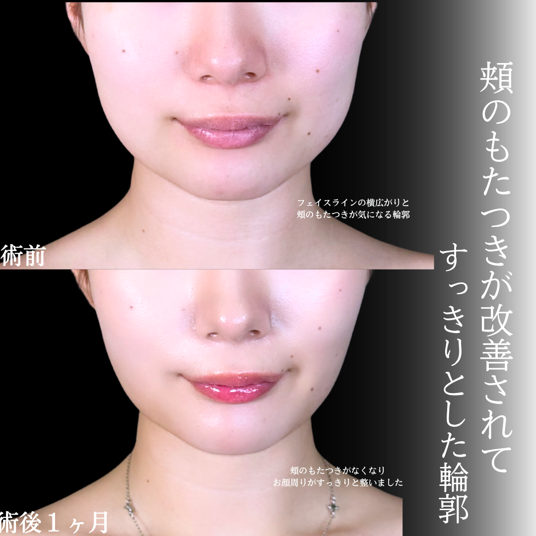 No.17047の症例写真1